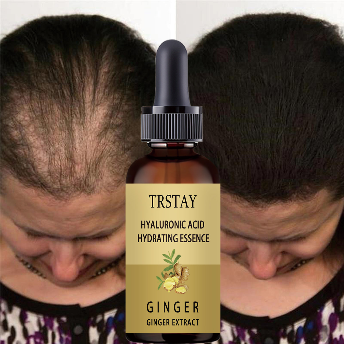 Serum na porost włosów zapobie – Hair Care Gisou recenzja i cena